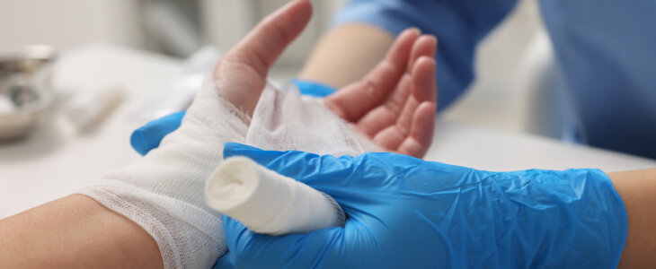 Doctor bandaging patient's burned hand in hospital, closeup