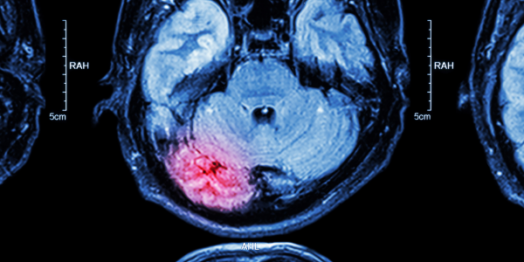 Brain injury scan